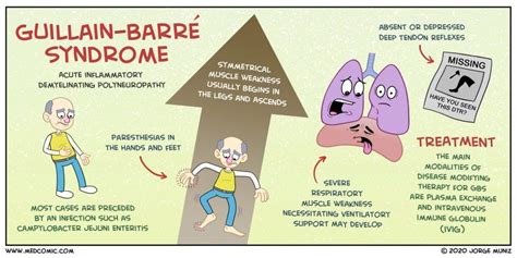 Gbs can occur at any age, but it is especially common in. Learn about Guillain-Barré syndrome with a Medcomic rap ...
