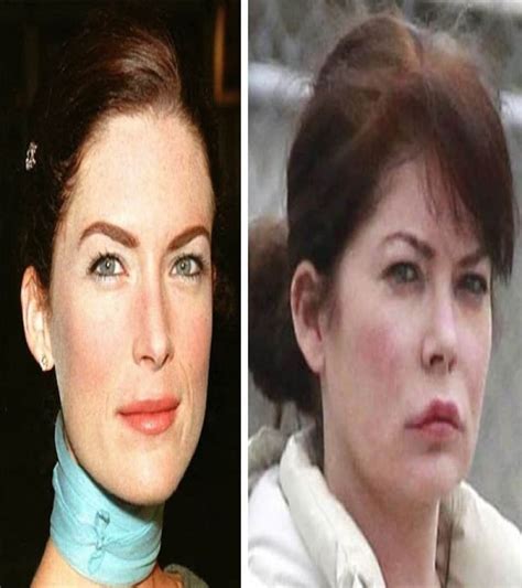 Worst Plastic Surgery List Images Collection Of Worst Plastic Surgery