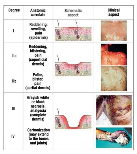 Describe The Three Classifications Of Burns