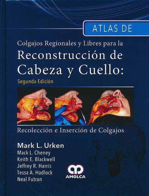 Atlas De Colgajos Regionales Y Libres Para La Reconstrucción De Cabeza