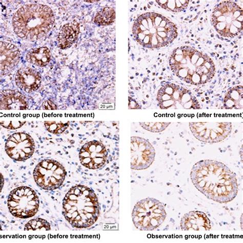 Expression Of VDR Protein In Colonic Mucosa In The Two Groups