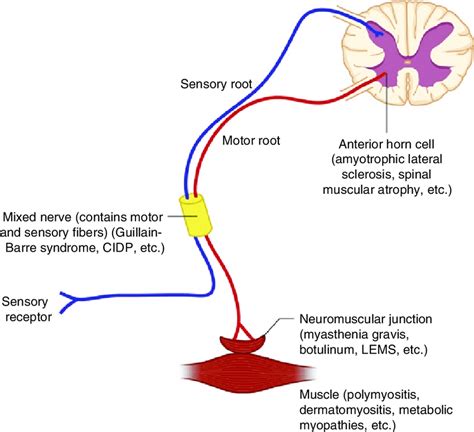 The Four Anatomic Stations Underlying Lower Motor Neuron Weakness