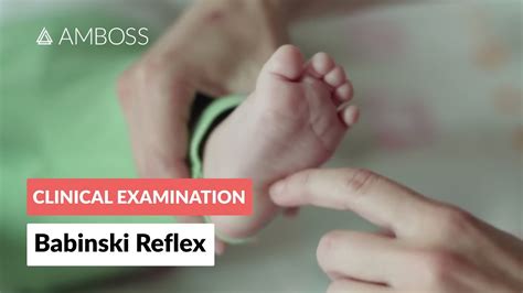 Babinski Reflex In Infants Clinical Examination Youtube