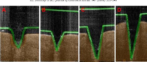 Figure From Optical Coherence Tomography Is A Valuable Tool In The Study Of The Effects Of