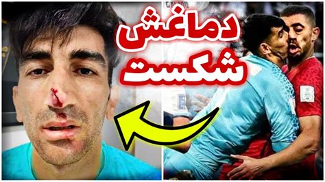 وضعیت علیرضا بیرانوند و شعار بازیکنان علیه ایران 🔴 Team Meli Iran Youtube