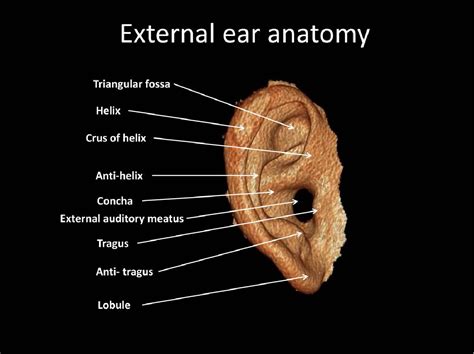 Figure From High Resolution Ct Of External Ear And External Auditory Canal Pathologies How