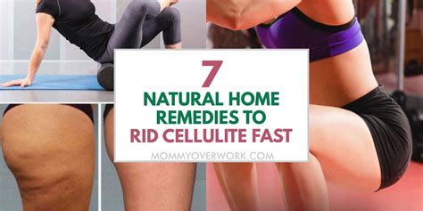 7 natural home remedies to get rid of cellulite fast