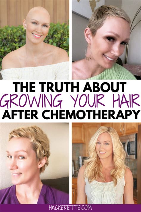 Hair Growth After Chemo Artofit