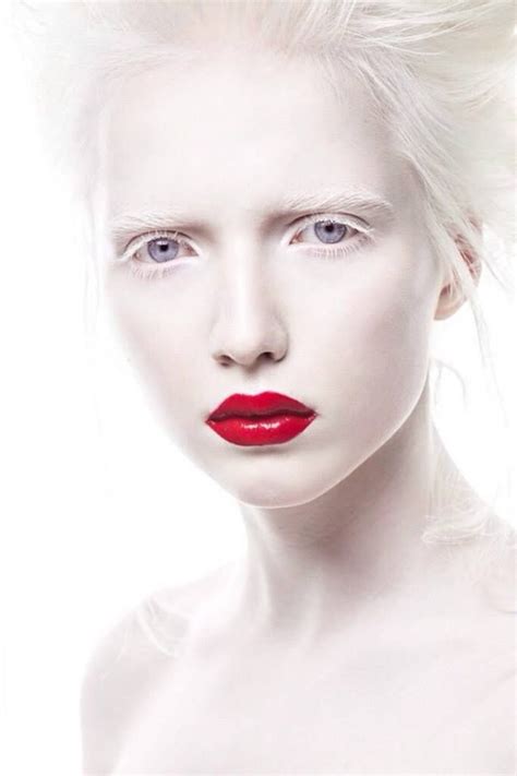 Nastya Kumarova Albino Girl Albino Model Albinism