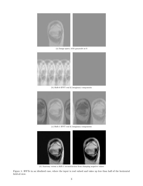 Offset Masking Improves Deep Learning Based Accelerated Mri Reconstructions Deepai
