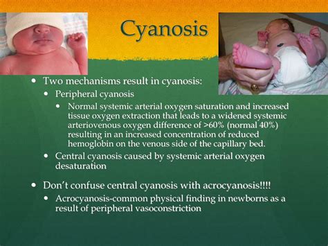 69 Best Of What Causes Central Cyanosis In Newborns Insectza