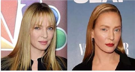 Uma Thurman Before And After Plastic Surgery Plastic Surgery
