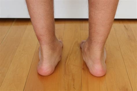Flat Feet And Treatment For Pronation Rivervale Podiatry