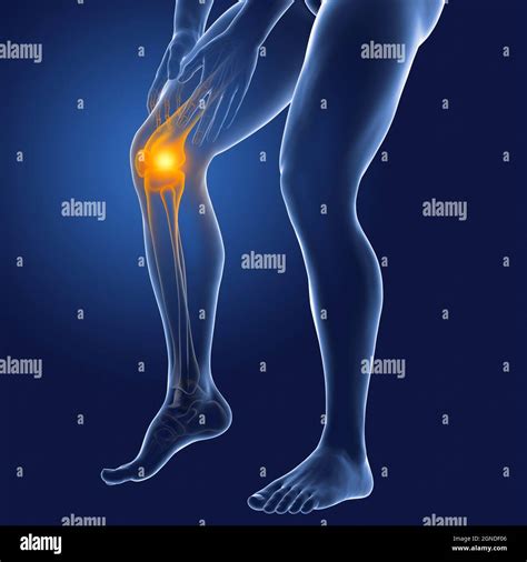 Human Knee Pain Illustration Stock Photo Alamy