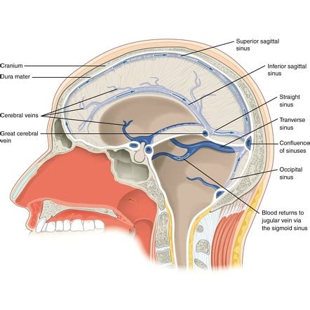 Dural Venous Sinuses Radiology Reference Article Radiopaedia Org