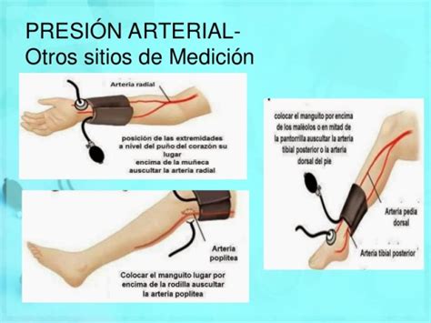 PresiÓn Arterial TÉcnica De MediciÓn