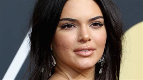 Kendall Jenner Says Suffering From Acne Was Debilitating For Her