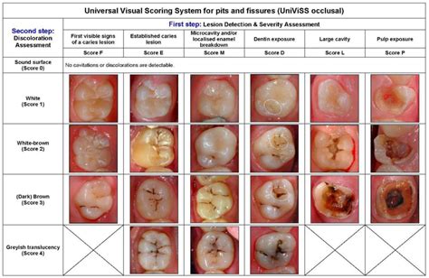 2012 classification of caries lesions of tooth surfaces and caries management systems. IJERPH | Free Full-Text | Development, Methodology and ...