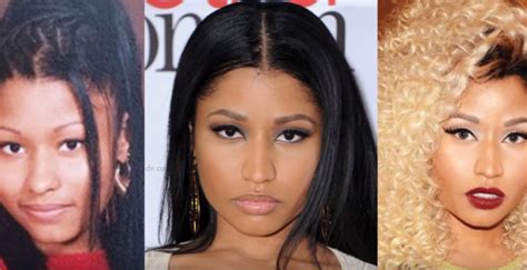 Nicki Minaj Before And After Plastic Surgery Top Piercings