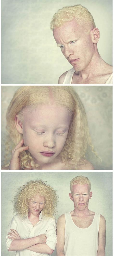 Épinglé par Cla sur pessoas pipou Visages intéressants Albinos