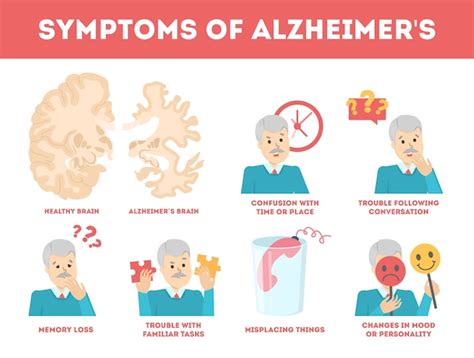 Premium Vector Alzheimer Disease Symptoms Infographic Memory Loss