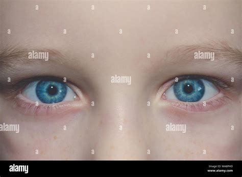 Baby Blue Beautiful Brooding Eyes Of A Boy Stock Photo Alamy