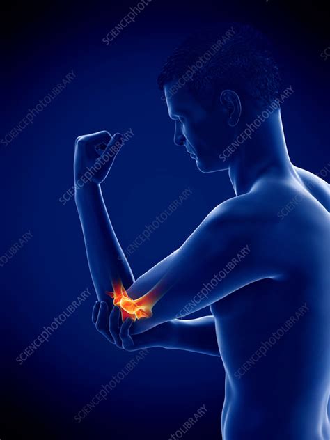 Man With Painful Elbow Illustration Stock Image F0352876