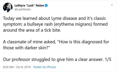 Touched By Lyme How Medical Education Misses The Lyme Bulls Eye