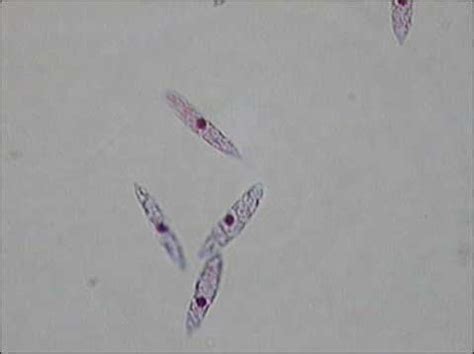 Post a question or comment about what for example, if you are looking for what stachybotrys chartarum spores and growth structures or conidiophores look like under. Lab Exam 1 at Sierra College - StudyBlue
