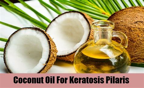 5 Effective Treatments For Keratosis Pilaris Natural Home Remedies
