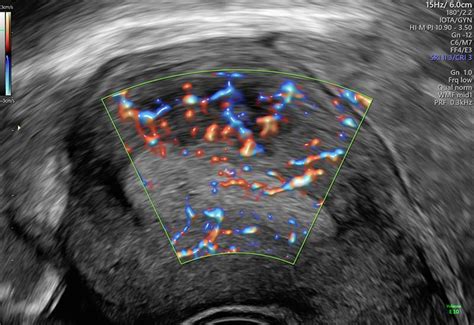Fertility Ultrasound Scan Empowered Womens Health