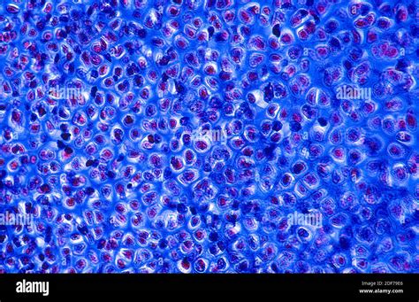 Hyaline Cartilage Is A Kind Of Cartilage Tissue Photomicrograph Stock