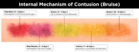 101 Series The Colorful Stages Of Skin Bruising Food For Skin