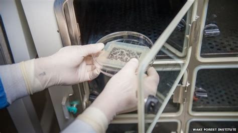 Doctors Implant Lab Grown Vagina Bbc News