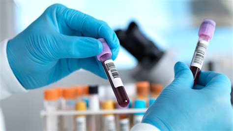 Multi Cancer Blood Test Shows Real Promise In Study