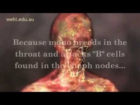 Infectious mononucleosis was first described by sprunt and evans in the bulletin of the johns hopkins hospital in 1920. Symptoms of Mono - Mono Symptoms - Infectious ...