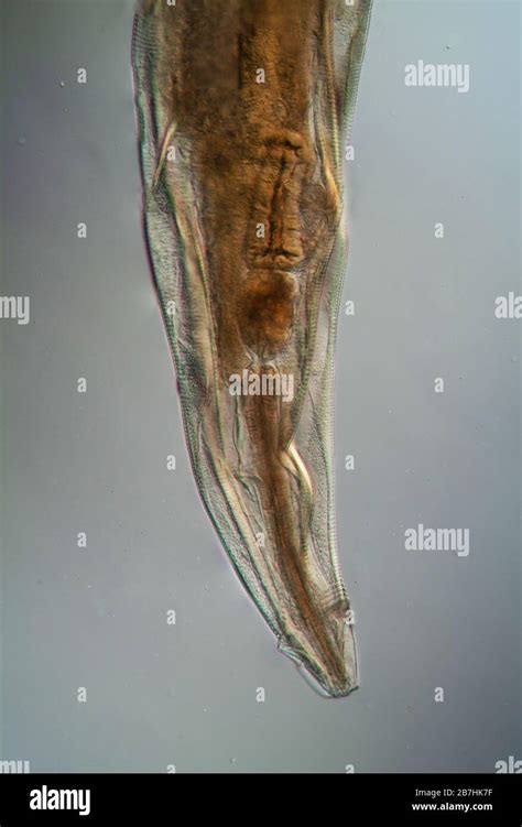 Pinworm Hi Res Stock Photography And Images Alamy