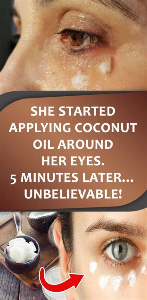 She Started Applying Coconut Oil Around Her Eyes 5 Minutes Later