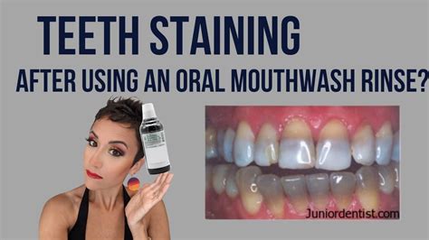 teeth staining after using chlorhexidine gluconate mouthwash can the oral rinse stain teeth