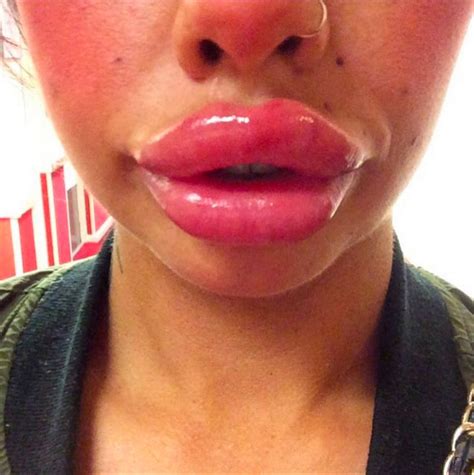 Squiggly Lips Are The Latest Fad Heres What You Hope You
