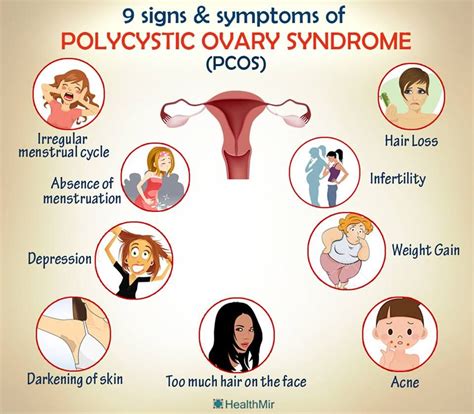 Pcos Polycystic Ovary Syndrome Women S Health Healthy Living