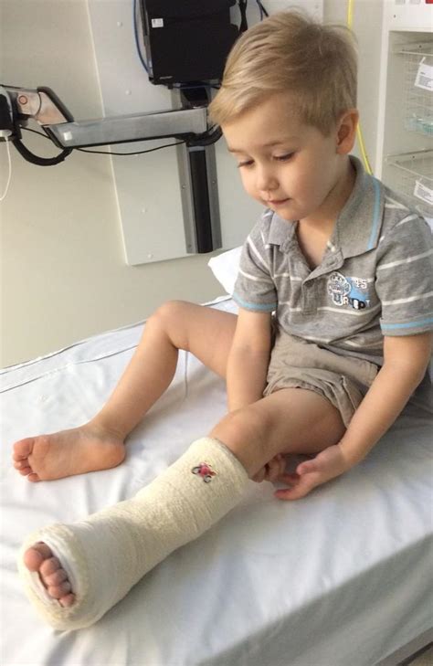 Lady Cilento Childrens Hospital Puts Boys Cast On Wrong Leg The