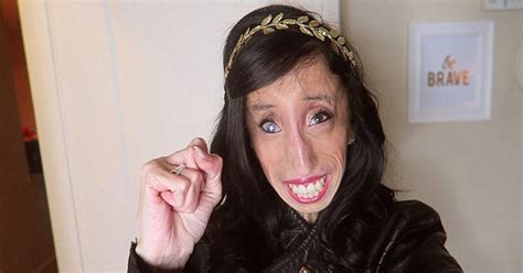 Bullies Named Her Ugliest Woman In The World Now Watch Her 25 Years