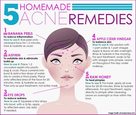 9 Natural And Vegan Ways To A Glowing And Acne Free Skin Acne Remedies Homemade Acne Remedies