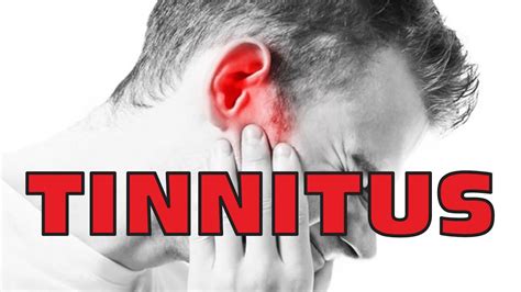 Get more information about other health issues ▻ best way to control diabetes: TINNITUS, Bukan salah telinga! — Dr. Noordin Darus - YouTube