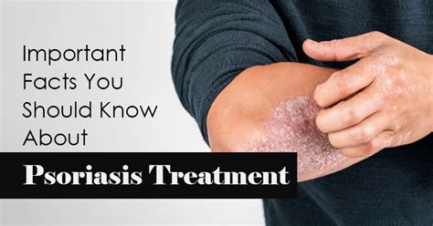 Facts To Know About Psoriasis Treatment Vedam Ayurveda