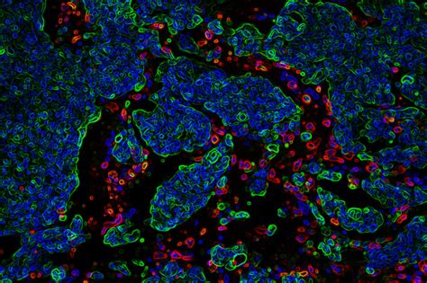 The title of the meeting, fromtarget to market, indicates the usefulness of animal cell technology during all steps in the pharmaceutical development process. New study reveals why breast cancer spreads to the brain