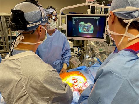 First Beating Heart Mitral Valve Repair On West Coast Performed At Ucsf
