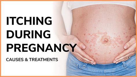Is It Normal To Be Itchy During Pregnancy Itching During Pregnancy