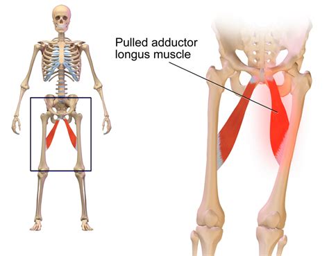 Pulled Groin Muscle Anatomy Image Credit Bruceblaus 2015 November